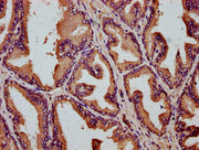 IHC image of CSB-PA741974LA01HU diluted at 1:200 and staining in paraffin-embedded human prostate tissue performed on a Leica BondTM system. After dewaxing and hydration, antigen retrieval was mediated by high pressure in a citrate buffer (pH 6.0)...