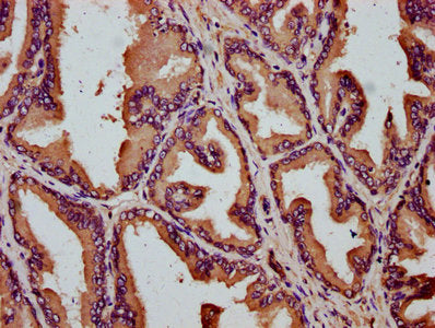 IHC image of CSB-PA741974LA01HU diluted at 1:200 and staining in paraffin-embedded human prostate tissue performed on a Leica BondTM system. After dewaxing and hydration, antigen retrieval was mediated by high pressure in a citrate buffer (pH 6.0)...