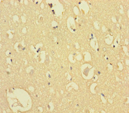 Immunohistochemistry of paraffin-embedded human brain tissue using CSB-PA741975LA01HU at dilution of 1:100