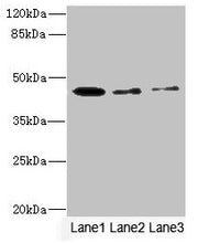 Western blot All lanes: SIGIRR antibody at 1.77µg/ml Lane 1: Mouse liver tissue Lane 2: Mouse kidney tissue Lane 3: MCF-7 whole cell lysate Secondary Goat polyclonal to rabbit IgG at 1/10000 dilution Predicted band size: 46, 56 kDa Observed band s...