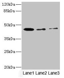 Western blot All lanes: SIGIRR antibody at 1.77µg/ml Lane 1: Mouse liver tissue Lane 2: Mouse kidney tissue Lane 3: MCF-7 whole cell lysate Secondary Goat polyclonal to rabbit IgG at 1/10000 dilution Predicted band size: 46, 56 kDa Observed band s...