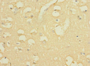 Immunohistochemistry of paraffin-embedded human brain tissue using CSB-PA743592LA01HU at dilution of 1:100