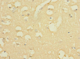 Immunohistochemistry of paraffin-embedded human brain tissue using CSB-PA743592LA01HU at dilution of 1:100