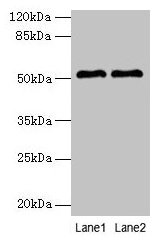 Western blot All lanes: SLC30A6 antibody at 6µg/ml Lane 1: A549 whole cell lysate Lane 2: U251 whole cell lysate Secondary Goat polyclonal to rabbit IgG at 1/10000 dilution Predicted band size: 52, 56, 48, 49 kDa Observed band size: 52 kDa