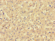 Immunohistochemistry of paraffin-embedded human liver tissue using CSB-PA744028LA01HU at dilution of 1:100