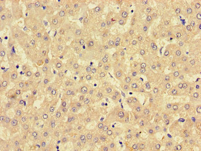 Immunohistochemistry of paraffin-embedded human liver tissue using CSB-PA744028LA01HU at dilution of 1:100