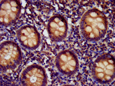 IHC image of CSB-PA744034LA01HU diluted at 1:400 and staining in paraffin-embedded human appendix tissue performed on a Leica BondTM system. After dewaxing and hydration, antigen retrieval was mediated by high pressure in a citrate buffer (pH 6.0)...