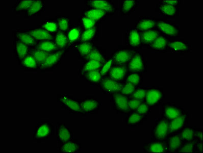 Immunofluorescence staining of Hela cells with CSB-PA744036LA01HU at 1:166, counter-stained with DAPI. The cells were fixed in 4% formaldehyde, permeabilized using 0.2% Triton X-100 and blocked in 10% normal Goat Serum. The cells were then incubat...