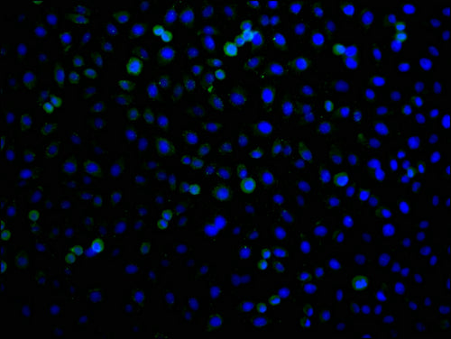 Immunofluorescence staining of A549 cells with CSB-PA744137LA21HU at 1:100, counter-stained with DAPI. The cells were fixed in 4% formaldehyde and blocked in 10% normal Goat Serum. The cells were then incubated with the antibody overnight at 4°C....