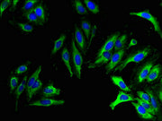 Immunofluorescent analysis of Hela cells using CSB-PA744250LA01HU at dilution of 1:100 and Alexa Fluor 488-congugated AffiniPure Goat Anti-Rabbit IgG(H+L)