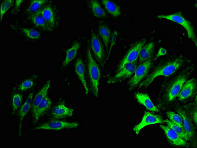 Immunofluorescent analysis of Hela cells using CSB-PA744250LA01HU at dilution of 1:100 and Alexa Fluor 488-congugated AffiniPure Goat Anti-Rabbit IgG(H+L)