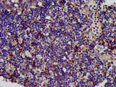 IHC image of CSB-PA744263LA01HU diluted at 1:400 and staining in paraffin-embedded human tonsil tissue performed on a Leica BondTM system. After dewaxing and hydration, antigen retrieval was mediated by high pressure in a citrate buffer (pH 6.0)....