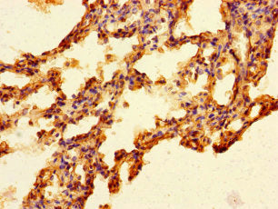 Immunohistochemistry of paraffin-embedded human lung tissue using CSB-PA744268LA01HU at dilution of 1:100