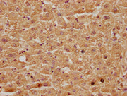 IHC image of CSB-PA744269LA01HU diluted at 1:100 and staining in paraffin-embedded human liver tissue performed on a Leica BondTM system. After dewaxing and hydration, antigen retrieval was mediated by high pressure in a citrate buffer (pH 6.0). S...