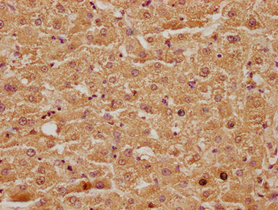 IHC image of CSB-PA744269LA01HU diluted at 1:100 and staining in paraffin-embedded human liver tissue performed on a Leica BondTM system. After dewaxing and hydration, antigen retrieval was mediated by high pressure in a citrate buffer (pH 6.0). S...