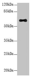 Western Blot All lanes: LRRC31 antibody at 5µg/ml + Mouse small intestine tissue Secondary Goat polyclonal to rabbit IgG at 1/10000 dilution Predicted band size: 62, 56, 39, 49 kDa Observed band size: 62 kDa