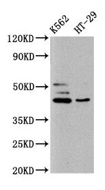 Western Blot Positive WB detected in: K562 whole cell lysate, HT29 whole cell lysate All lanes: B3GNT6 antibody at 10µg/ml Secondary Goat polyclonal to rabbit IgG at 1/50000 dilution Predicted band size: 43, 30 kDa Observed band size: 43 kDa