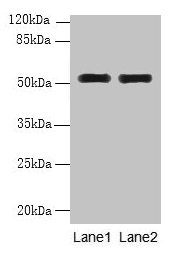 Western blot All lanes: WDR88 antibody at 6µg/ml Lane 1: MCF-7 whole cell lysate Lane 2: A549 whole cell lysate Secondary Goat polyclonal to rabbit IgG at 1/10000 dilution Predicted band size: 53, 48 kDa Observed band size: 53 kDa