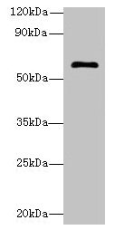 Western blot All lanes: GK5 antibody at 4µg/ml + K562 whole cell lysate Secondary Goat polyclonal to rabbit IgG at 1/10000 dilution Predicted band size: 60, 34, 28 kDa Observed band size: 60 kDa