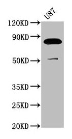 Western Blot Positive WB detected in: U87 whole cell lysate All lanes: FRMD7 antibody at 3.7µg/ml Secondary Goat polyclonal to rabbit IgG at 1/50000 dilution Predicted band size: 82, 80 kDa Observed band size: 82 kDa