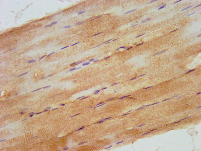 IHC image of CSB-PA745331LA01HU diluted at 1:500 and staining in paraffin-embedded human skeletal muscle tissue performed on a Leica BondTM system. After dewaxing and hydration, antigen retrieval was mediated by high pressure in a citrate buffer (...