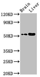 Western Blot Positive WB detected in: Mouse brain tissue, Mouse liver tissue All lanes: CHST9 antibody at 2.8ug/ml Secondary Goat polyclonal to rabbit IgG at 1/50000 dilution Predicted band size: 53 kDa Observed band size: 53 kDa