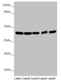 Western blot All lanes: EIF3M antibody at 2.02µg/ml Lane 1: Hela whole cell lysate Lane 2: A549 whole cell lysate Lane 3: Mouse gonadal tissue Lane 4: Human placenta tissue Lane 5: Mouse brain tissue Secondary Goat polyclonal to rabbit IgG at 1/10...