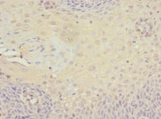 Immunohistochemistry of paraffin-embedded human tonsil tissue using CSB-PA745335ESR2HU at dilution of 1:100