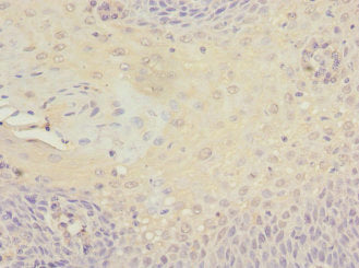 Immunohistochemistry of paraffin-embedded human tonsil tissue using CSB-PA745335ESR2HU at dilution of 1:100
