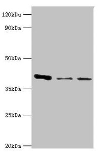 Western blot All lanes: E3 Ribonucleoside-diphosphate reductase subunit M2 B antibody at 6ug/ml Lane 1: MCF-7 whole cell lysate Lane 2: Hela whole cell lysate Lane 3: HepG2 whole cell lysate Secondary Goat polyclonal to rabbit IgG at 1/10000 dilut...