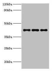 Western blot All lanes: RRM2B antibody at 3ug/ml Lane 1: MCF-7 whole cell lysate Lane 2: Hela whole cell lysate Lane 3: HepG2 whole cell lysate Secondary Goat polyclonal to rabbit IgG at 1/10000 dilution Predicted band size: 41, 35, 16, 8, 5, 49 k...