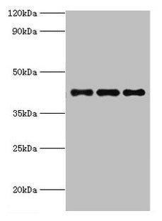 Western blot All lanes: RRM2B antibody at 3ug/ml Lane 1: MCF-7 whole cell lysate Lane 2: Hela whole cell lysate Lane 3: HepG2 whole cell lysate Secondary Goat polyclonal to rabbit IgG at 1/10000 dilution Predicted band size: 41, 35, 16, 8, 5, 49 k...