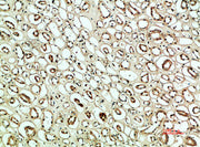 Immunohistochemical analysis of paraffin-embedded human-kidney, antibody was diluted at 1:200