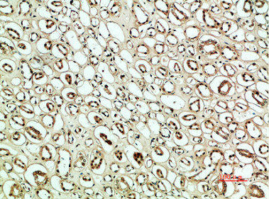 Immunohistochemical analysis of paraffin-embedded human-kidney, antibody was diluted at 1:200