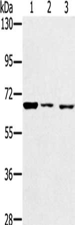 Gel: 6%SDS-PAGE, Lysate: 40 ug, Lane 1-3: A172 cells, hela cells, hepg2 cells, Primary antibody: CSB-PA745585(IGF2BP3 Antibody) at dilution 1/200, Secondary antibody: Goat anti rabbit IgG at 1/8000 dilution, Exposure time: 20 seconds