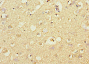 Immunohistochemistry of paraffin-embedded human brain tissue using CSB-PA745759ESR1HU at dilution of 1:100