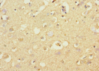 Immunohistochemistry of paraffin-embedded human brain tissue using CSB-PA745759ESR1HU at dilution of 1:100