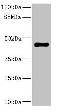 Western blot All lanes: STRADA antibody IgG at 1.98ug/ml + Rat heart tissue Secondary Goat polyclonal to rabbit IgG at 1/10000 dilution Predicted band size: 49, 39, 44, 34, 42, 35 kDa Observed band size: 49 kDa