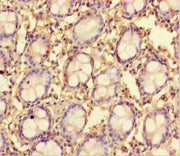 Immunohistochemistry of paraffin-embedded human colon tissue using CSB-PA745764LA01HU at dilution of 1:100