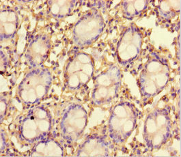 Immunohistochemistry of paraffin-embedded human colon tissue using CSB-PA745764LA01HU at dilution of 1:100