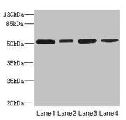 Western blot All lanes: CD276 antibody at 0.48µg/ml Lane 1: U251 whole cell lysate Lane 2: Jurkat whole cell lysate Lane 3: HepG2 whole cell lysate Lane 4: 293T whole cell lysate Secondary Goat polyclonal to rabbit IgG at 1/10000 dilution Predicte...