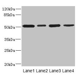 Western blot All lanes: CD276 antibody at 0.48µg/ml Lane 1: U251 whole cell lysate Lane 2: Jurkat whole cell lysate Lane 3: HepG2 whole cell lysate Lane 4: 293T whole cell lysate Secondary Goat polyclonal to rabbit IgG at 1/10000 dilution Predicte...