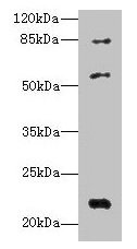 Western blot All lanes: PYHIN1 antibody at 6µg/ml + Mouse small intestine tissue Secondary Goat polyclonal to rabbit IgG at 1/10000 dilution Predicted band size: 56, 55, 52, 51, 27, 26 kDa Observed band size: 56, 22, 84 kDa