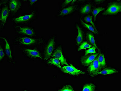 Immunofluorescent analysis of Hela cells using CSB-PA747224LA01HU at dilution of 1:100 and Alexa Fluor 488-congugated AffiniPure Goat Anti-Rabbit IgG(H+L)