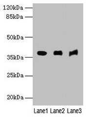 Western blot All lanes: MRNIP antibody at 4µg/ml Lane 1: Mouse kidney tissue Lane 2: Mouse heart tissue Lane 3: Hela whole cell lysate Secondary Goat polyclonal to rabbit IgG at 1/10000 dilution Predicted band size: 38, 30, 32 kDa Observed band si...