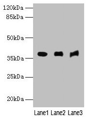 Western blot All lanes: MRNIP antibody at 4µg/ml Lane 1: Mouse kidney tissue Lane 2: Mouse heart tissue Lane 3: Hela whole cell lysate Secondary Goat polyclonal to rabbit IgG at 1/10000 dilution Predicted band size: 38, 30, 32 kDa Observed band si...