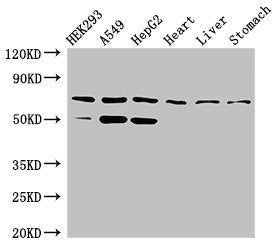 Western Blot Positive WB detected in: HEK293 whole cell lysate, A549 whole cell lysate, HepG2 whole cell lysate, Rat heart tissue, Rat liver tissue, Rat stomach tissue All lanes: TCTN3 antibody at 3.5µg/ml Secondary Goat polyclonal to rabbit IgG a...