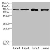 Western blot All lanes: XRRA1 antibody at 6µg/ml Lane 1: HepG2 whole cell lysate Lane 2: Mouse kidney tissue Lane 3: HL60 whole cell lysate Lane 4: U251 whole cell lysate Secondary Goat polyclonal to rabbit IgG at 1/10000 dilution Predicted band s...