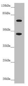 Western blot All lanes: SLC39A4 antibody at 4.45 ug/ml + Colo320 whole cell lysate Secondary Goat polyclonal to rabbit IgG at 1/10000 dilution Predicted band size: 69, 67 kDa Observed band size: 69, 47 kDa