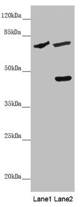 Western blot All lanes: SLC39A4 antibody at 5 ug/ml Lane 1: Mouse stomach tissue Lane 2: 293T whole cell lysate Secondary Goat polyclonal to rabbit IgG at 1/10000 dilution Predicted band size: 69, 67 kDa Observed band size: 69, 47 kDa